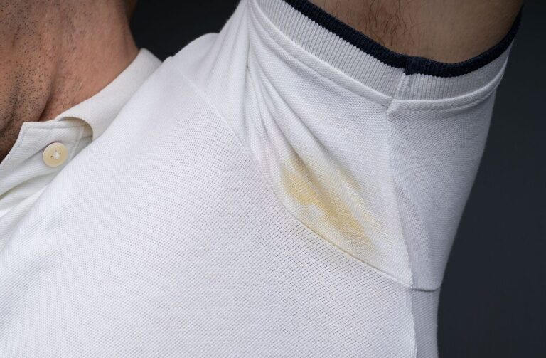 Como Quitar Manchas de Desodorante de la Ropa [Trucos]